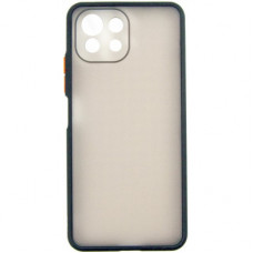 Чохол до мобільного телефона Dengos Matte Xiaomi Mi 11 Lite (black) (DG-TPU-MATT-75)